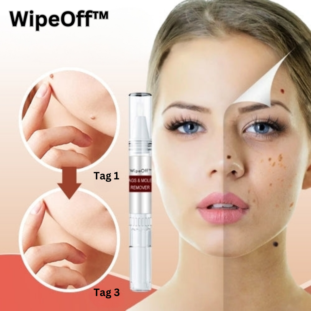 WipeOff™ Hautanhängsel & Maulwurfsentferner (1+1 GRATIS)
