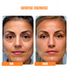 SkinGlow™ Anti-Aging-Maske (1+1 GRATIS)