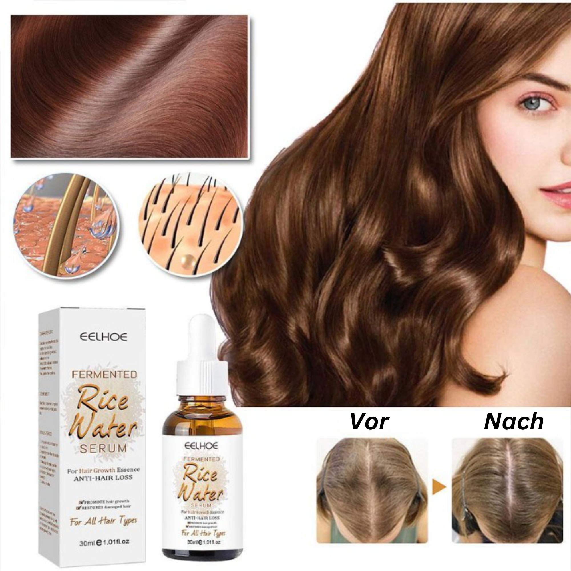EELHOE™️ I Reis-Haarwachstumsserum (1+1 GRATIS)