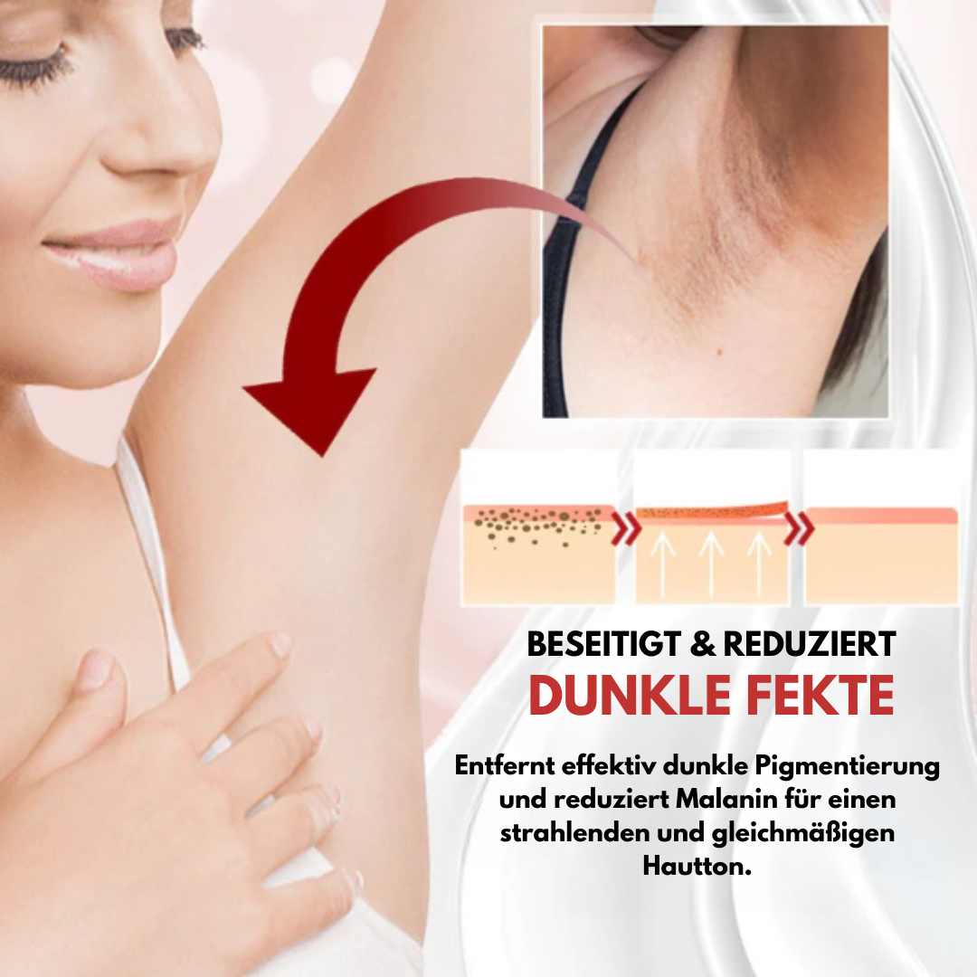DETVFO™ Creme zur Entfernung dunkler Flecken