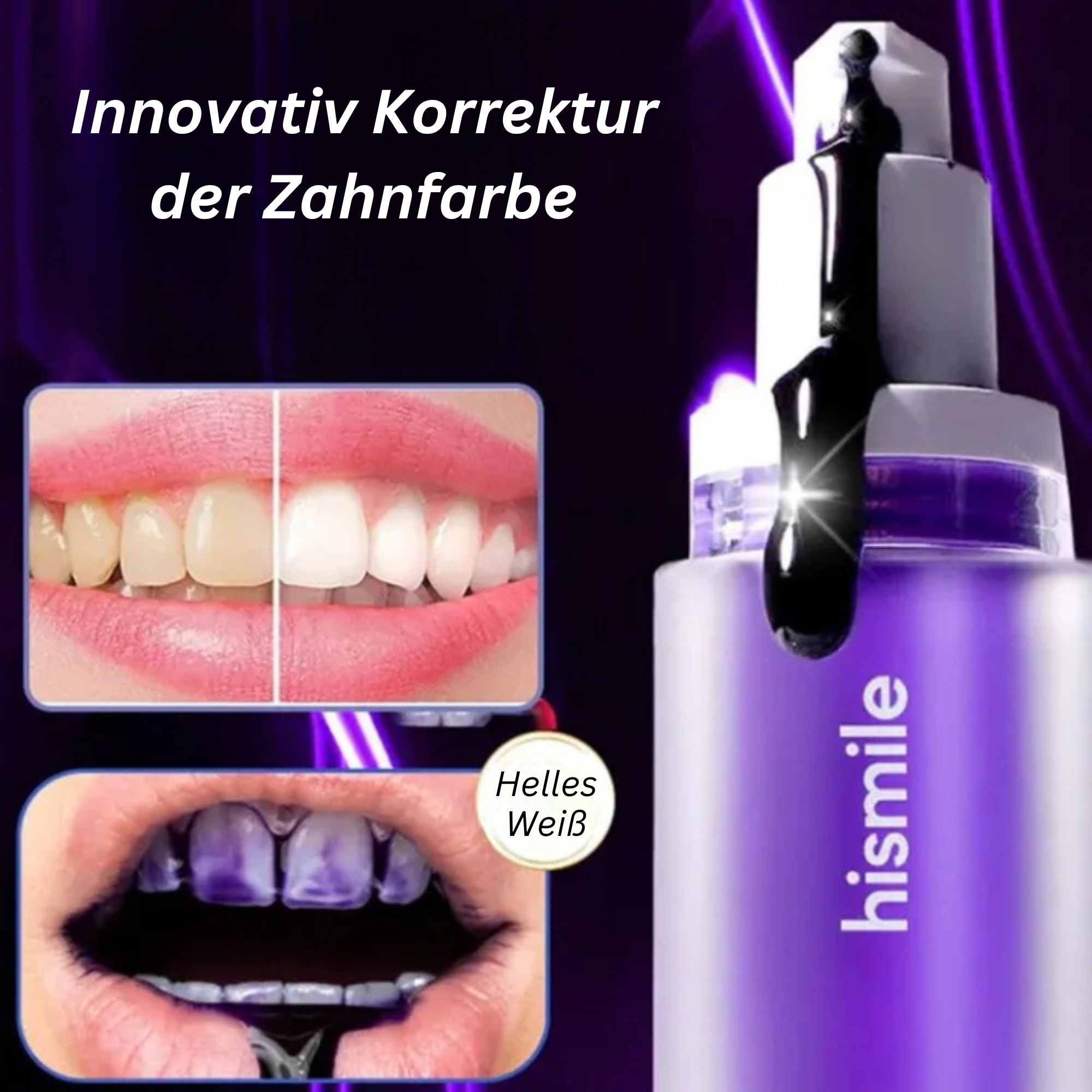 Hismile™️ I Aufhellende lila Zahnpasta (1+1 GRATIS)