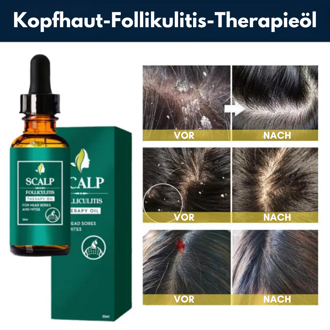 FolliCare™ Follikulitis Therapieöl für die Kopfhaut (1+1 GRATIS)