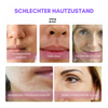 InstaLift™ Gesichtsstraffendes Ampullenserum (7 Stücke)