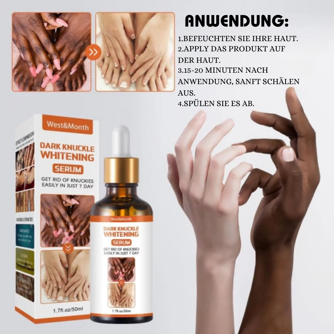 West&Month™ Serum zur Aufhellung dunkler Knöchel (1+1 GRATIS)