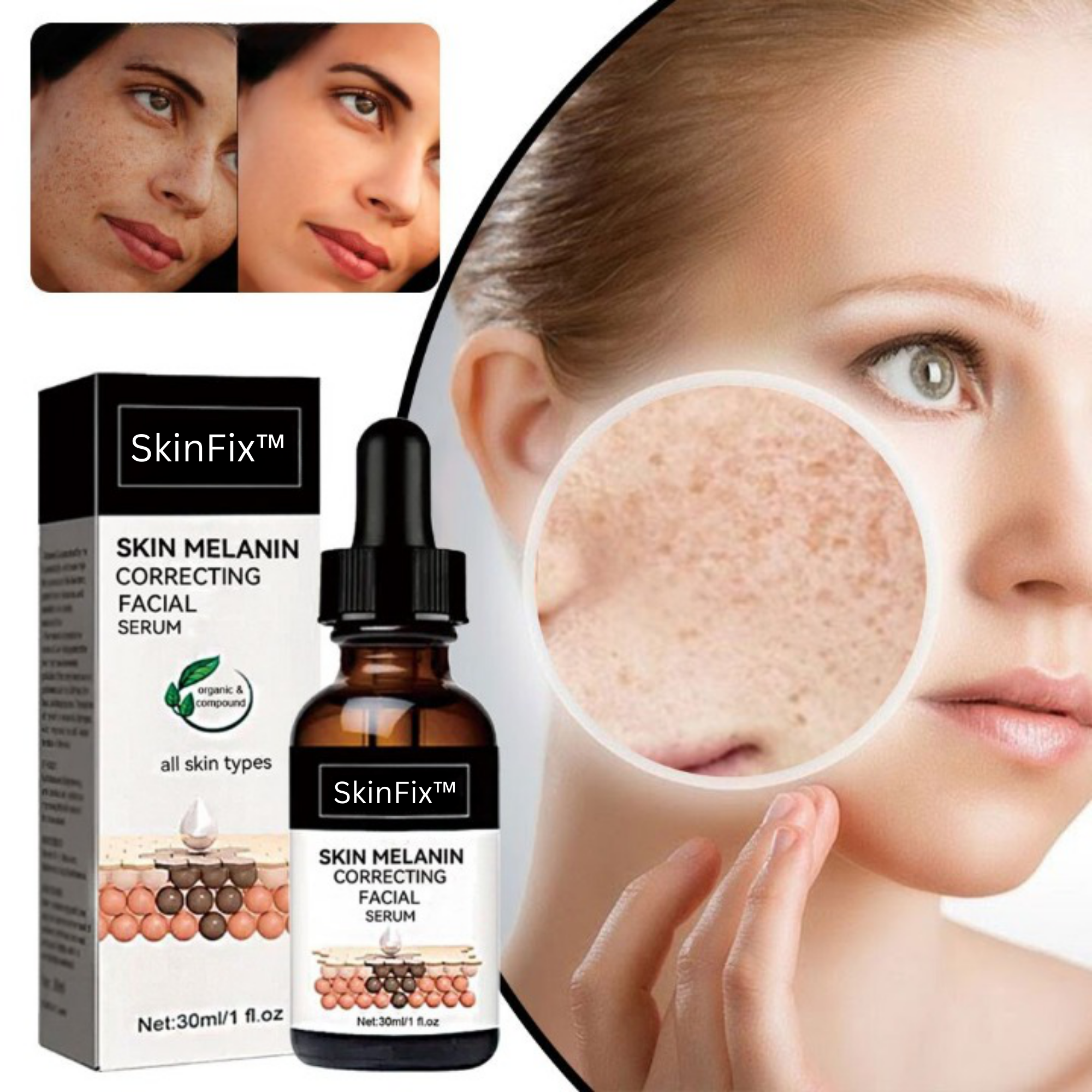 SkinFix™️ I Melanin korrigierendes Gesichtsserum (1+1 GRATIS)
