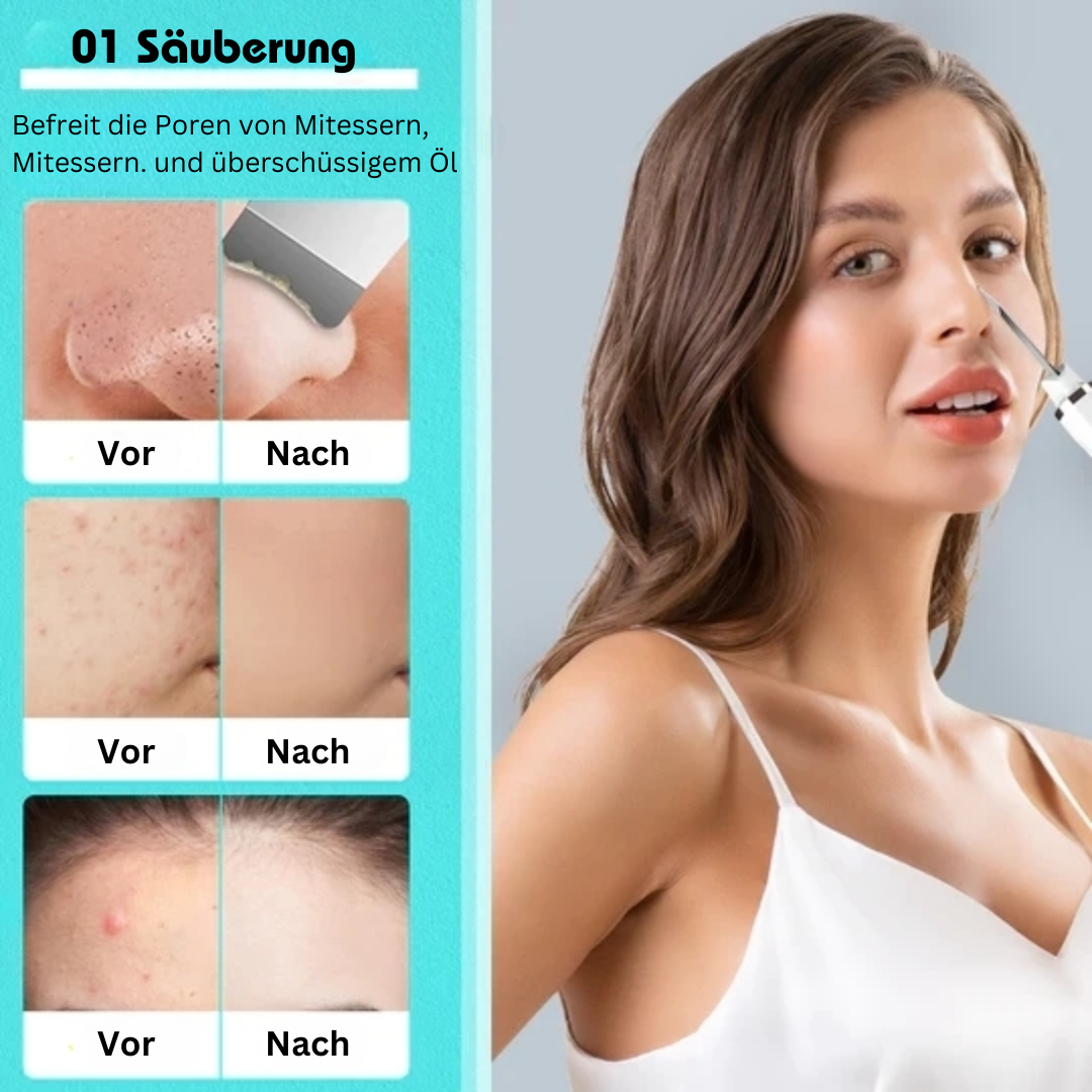 LIBEREX™ Ultraschall-Hautschrubber