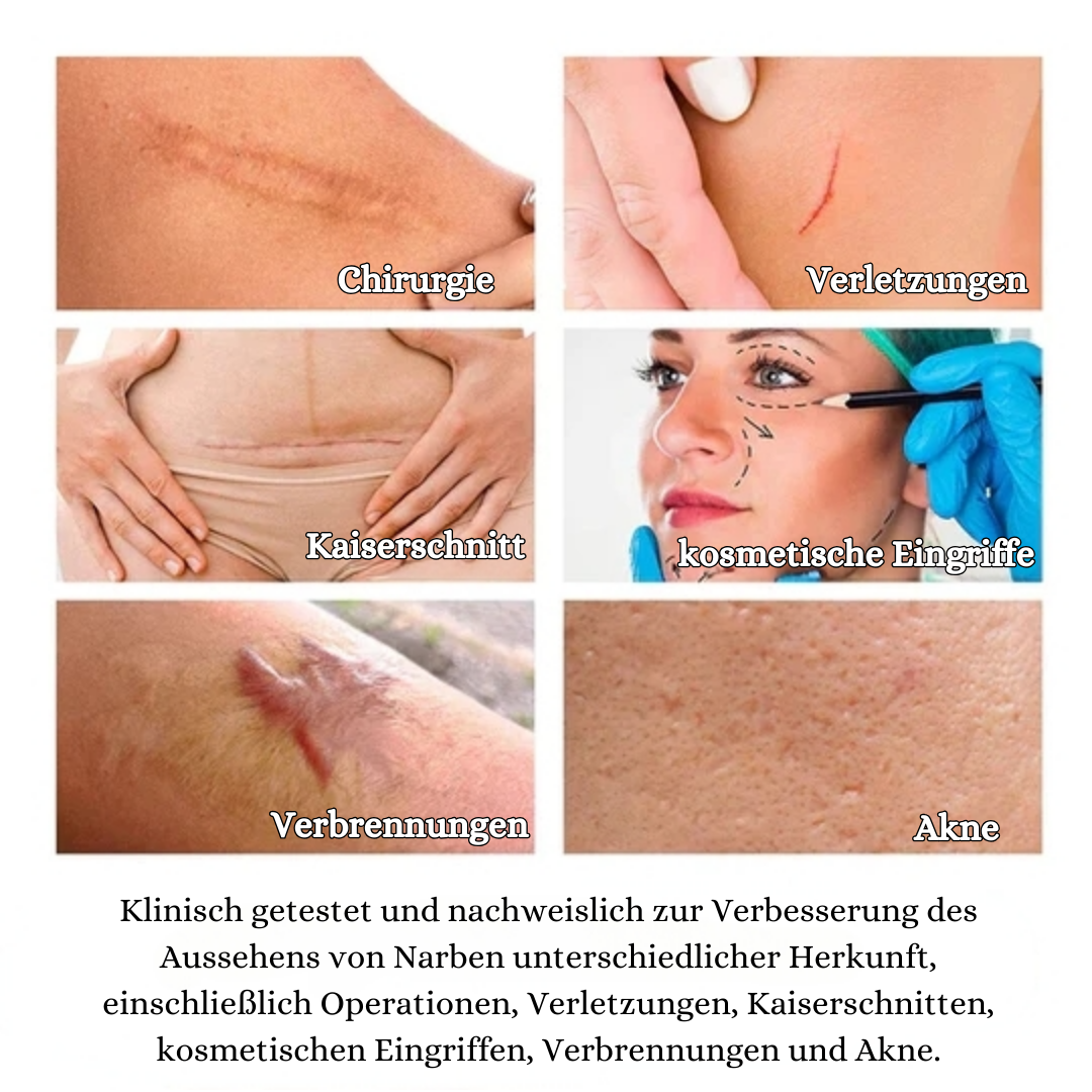 ScarVanish™ Narbe Entfernungsgel