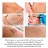 ScarVanish™ Narbe Entfernungsgel