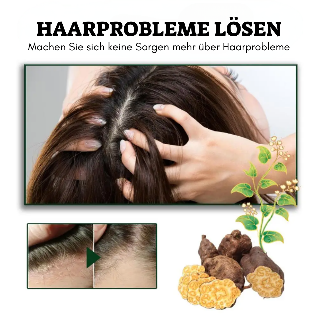 FolliCare™ Follikulitis Therapieöl für die Kopfhaut (1+1 GRATIS)