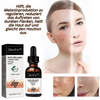 SkinFix™️ I Melanin korrigierendes Gesichtsserum (1+1 GRATIS)