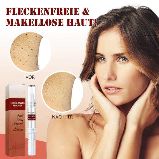 MoleFix™ Hautanhängsel & Maulwurfsentferner (1+1 GRATIS)