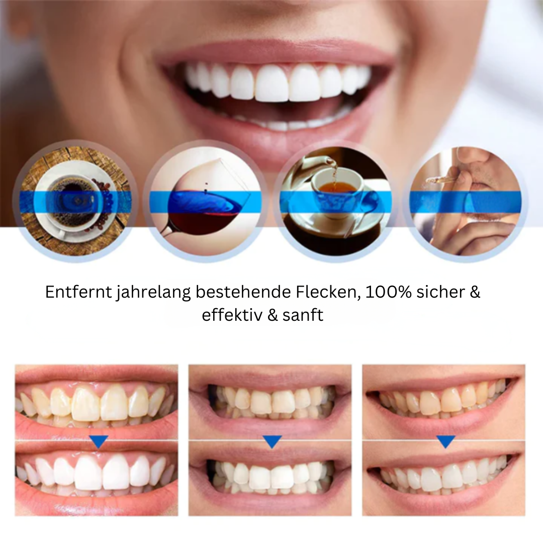 LANTHOME™ Essenz zur Zahnaufhellung (1+1 GRATIS)