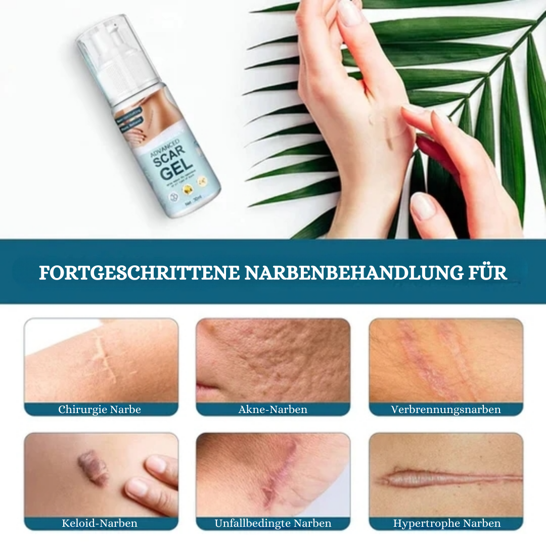 ScarVanish™ Narbe Entfernungsgel