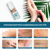 ScarVanish™ Narbe Entfernungsgel