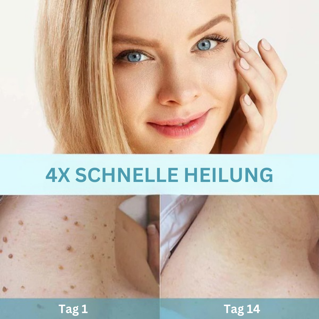 DermaFix™ Pflaster zur Entfernung von Hautmarkierungen