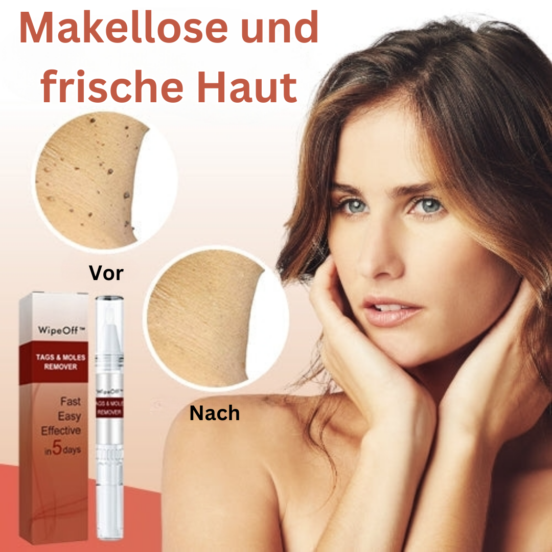 WipeOff™ Hautanhängsel & Maulwurfsentferner (1+1 GRATIS)