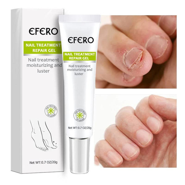 EFERO™ Nagelbehandlung Gel (1+1 GRATIS)