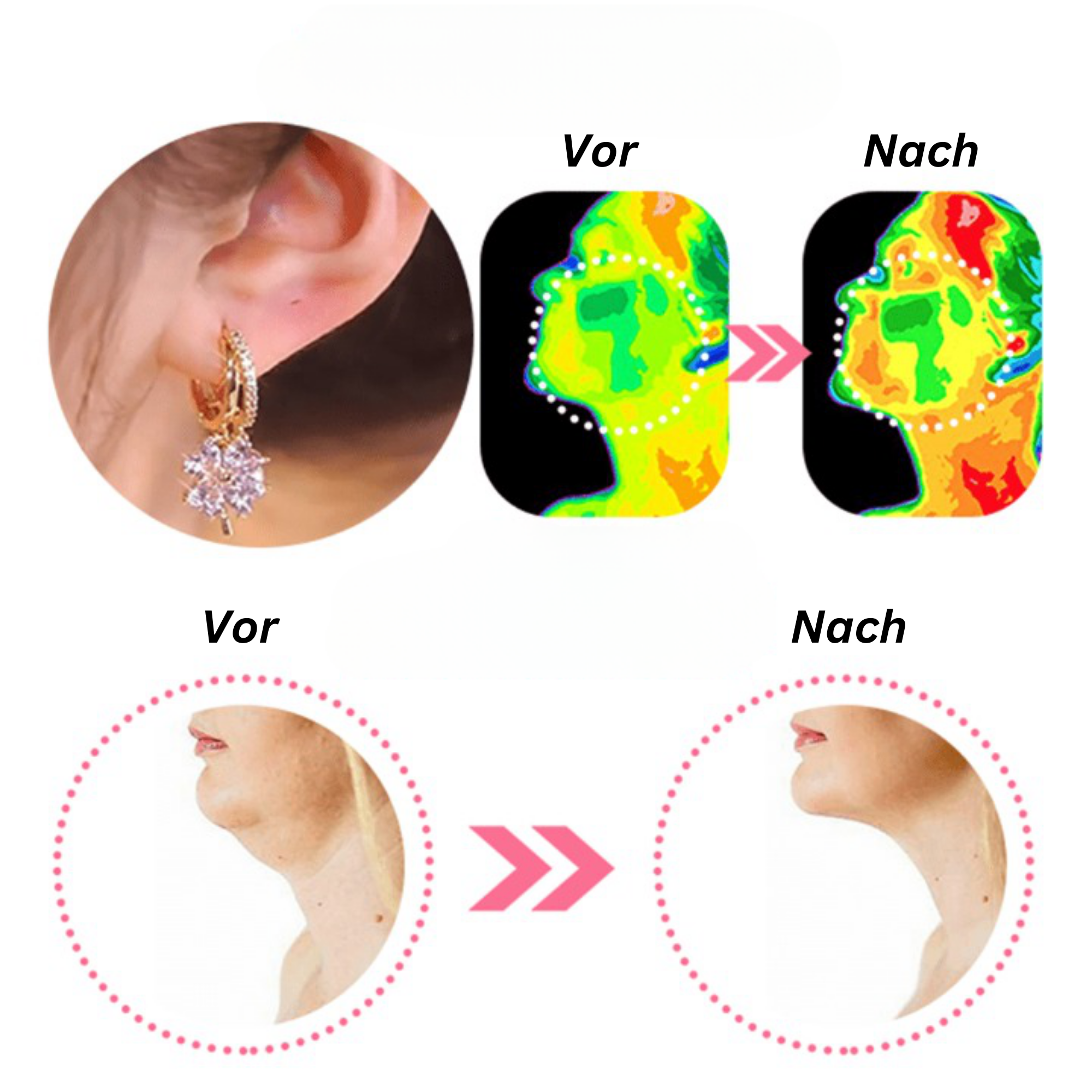 EarPear™️ I Magnettherapie Germanium-Ohrringe (1+1 GRATIS)