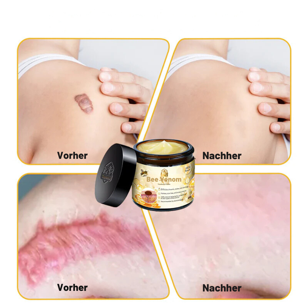 Beelixir™ Bienengift Hautbehandlung Creme