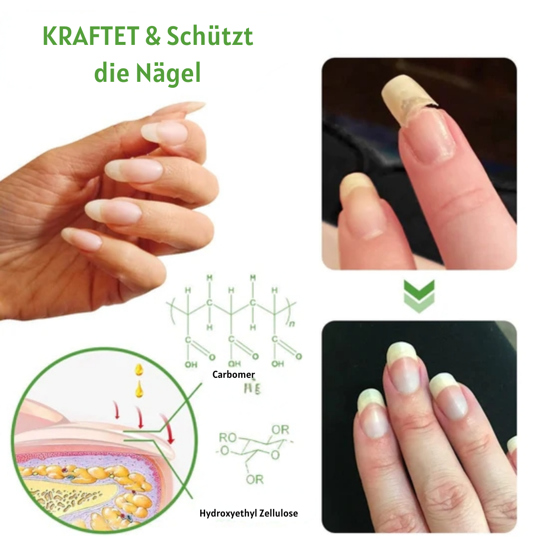 NailFix™ Nagelwachstum und Reparatur Roller (1+1 GRATIS)