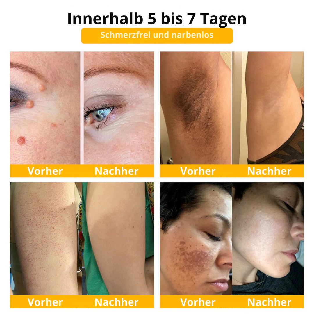 Beelixir™ Bienengift Hautbehandlung Creme