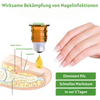 NailFix™ Nagelwachstum und Reparatur Roller (1+1 GRATIS)