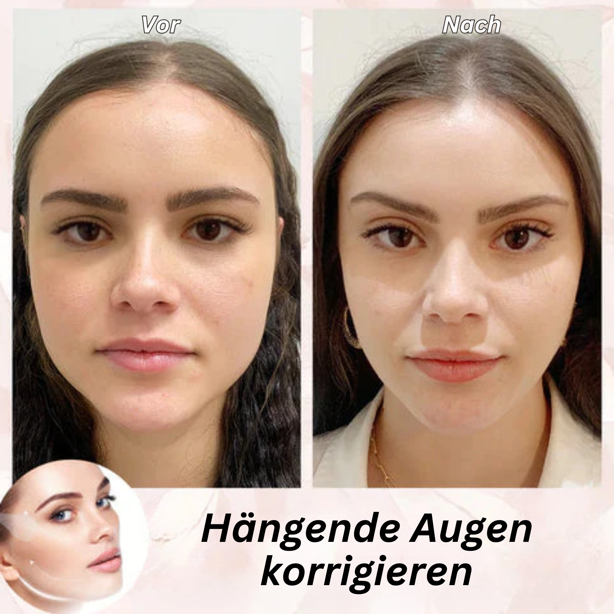 BeautyLift™️ I Unsichtbares Gesichtslifting-Band