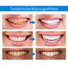 LANTHOME™ Essenz zur Zahnaufhellung (1+1 GRATIS)