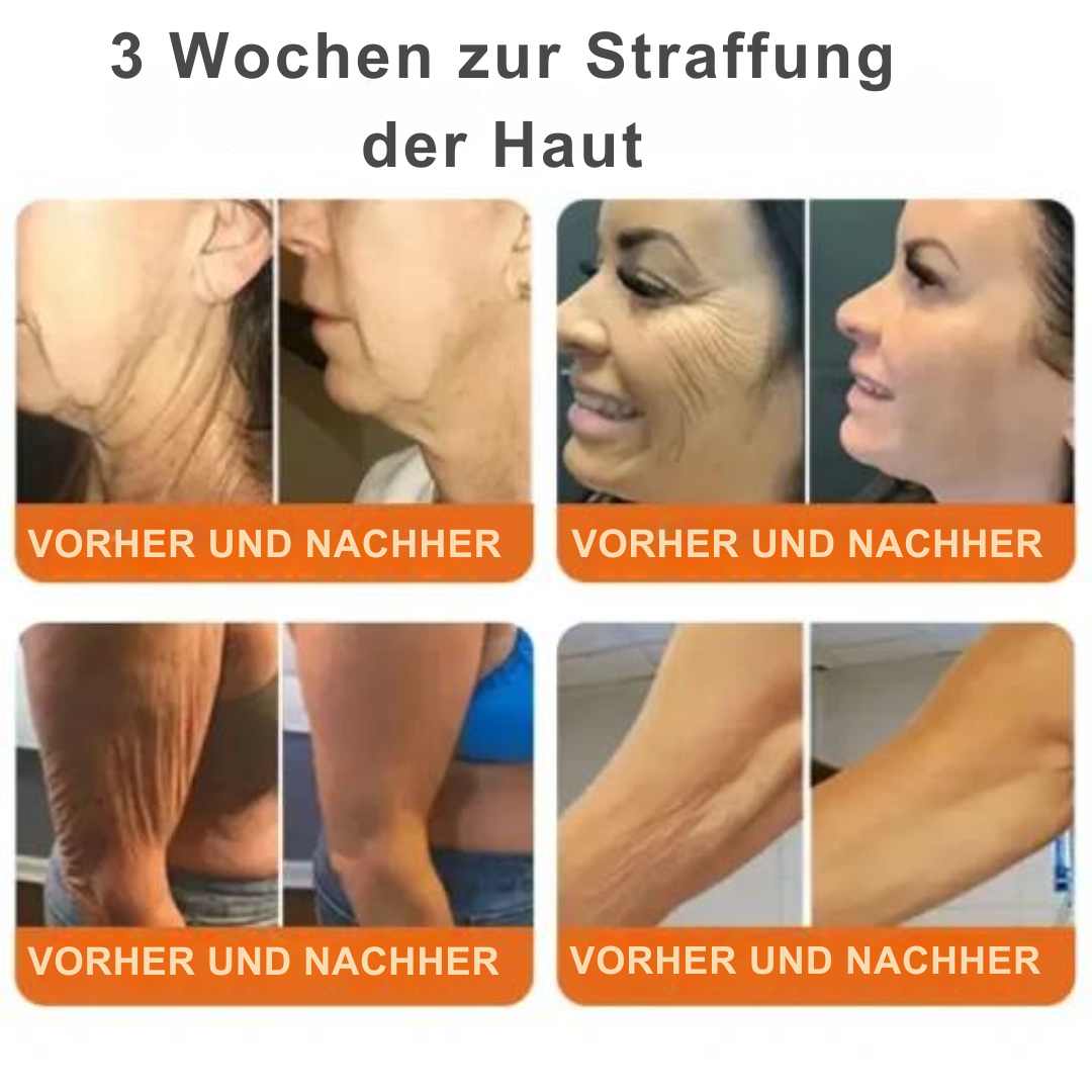 Flysmus™ - Straffendes Serum Stick