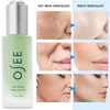 Osee™ - Anti-Aging-Serum
