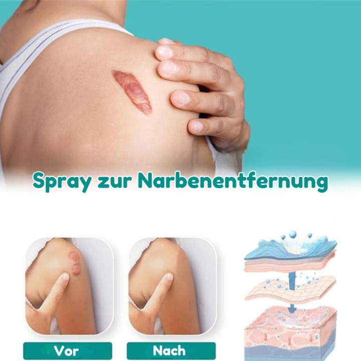 ScarVanish™ - Fortgeschrittenes Narbenentfernungsspray