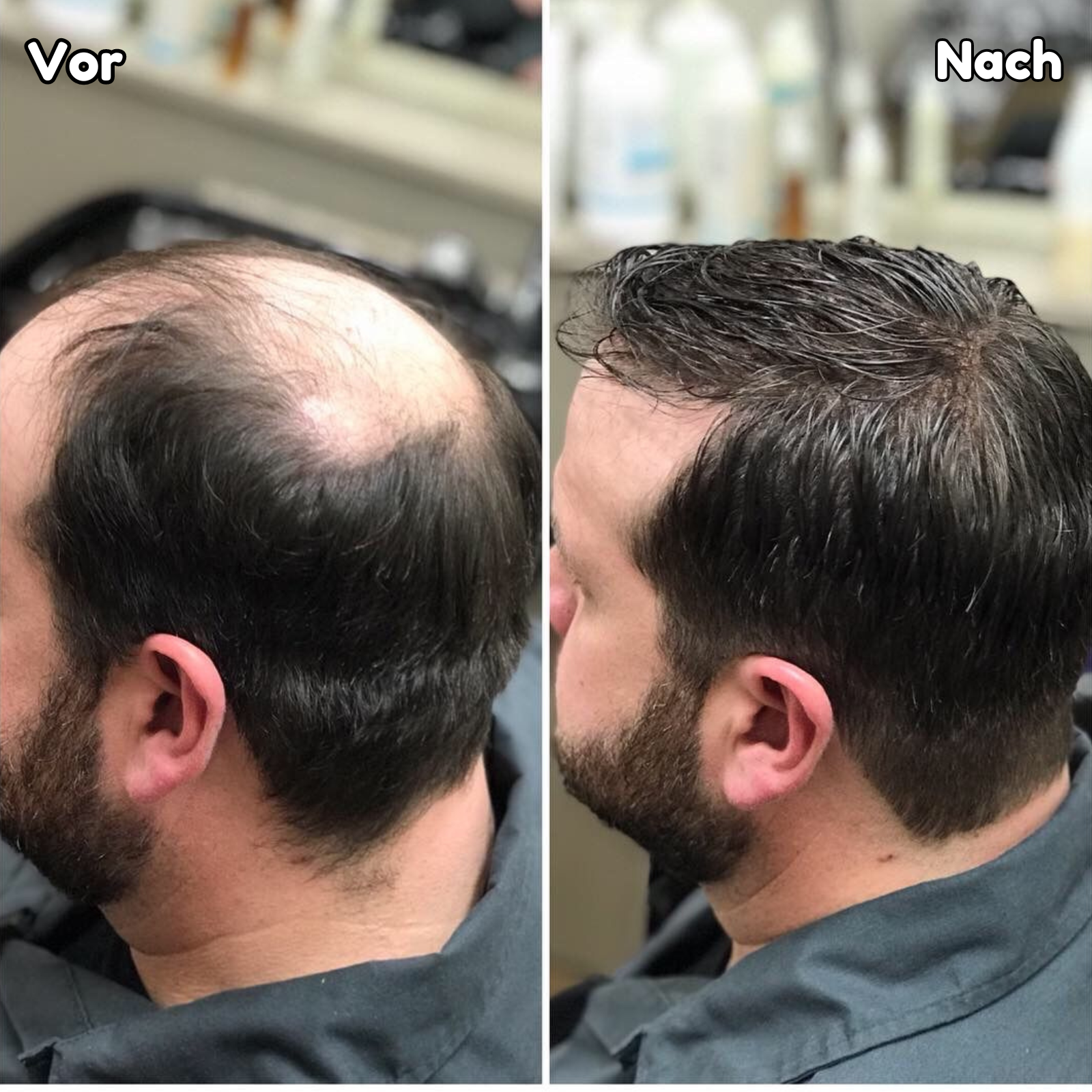 HaloHair™ - Haarwachstumsserum