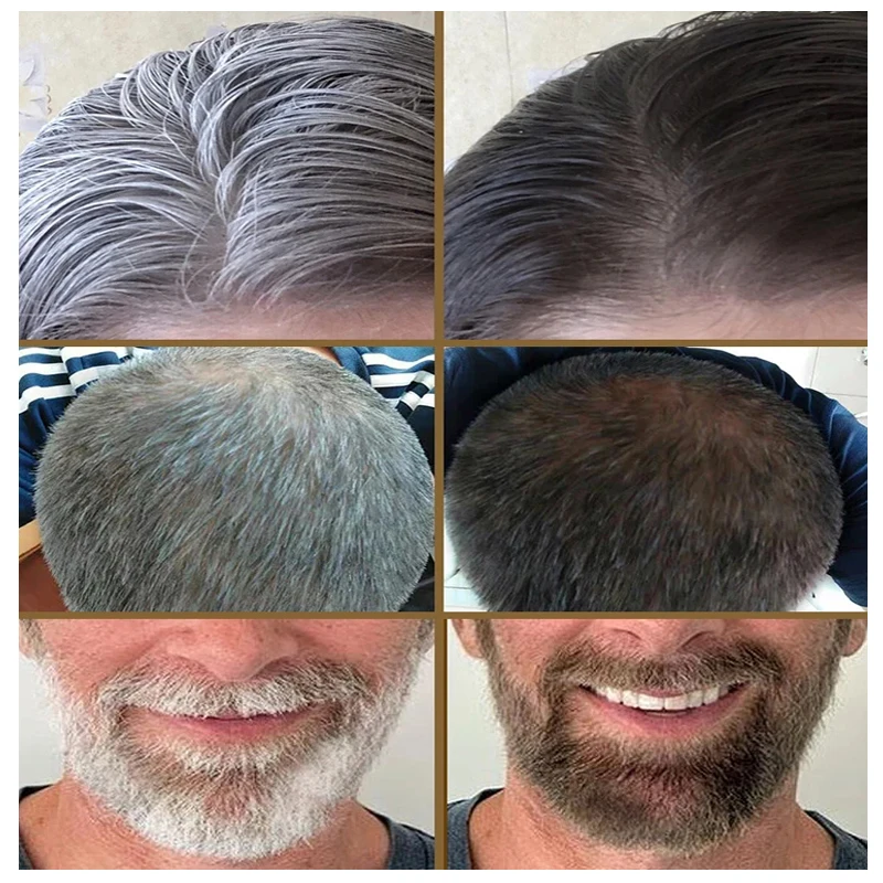 RootShade™ - Haarfarb-Restaurator für graues Haar