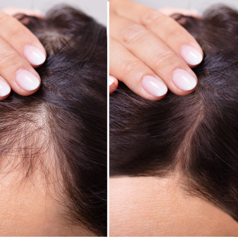 HairVive™ - Anti-Haarausfall Ingwer-Shampoo-Bar