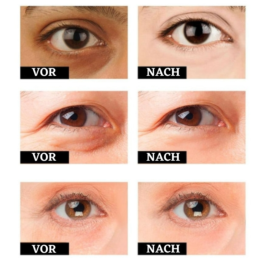 RevitaEyes™ Straffende Augencreme