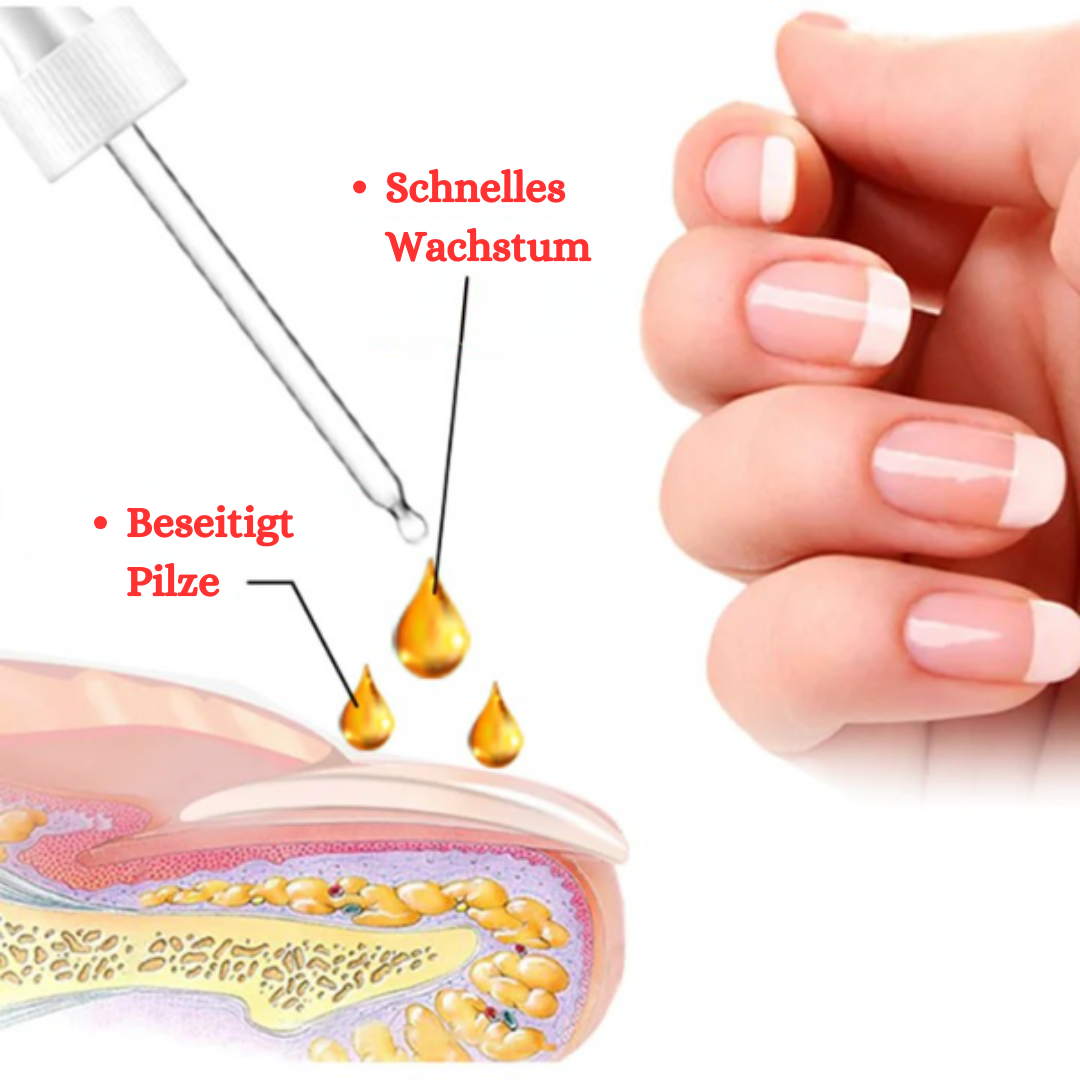 VitaGlow™ Nagelreparatur-Serum (1+1 GRATIS)