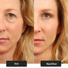 VitalEyes™ - Peptid-Abschwellendes Augengel (1+1 GRATIS)