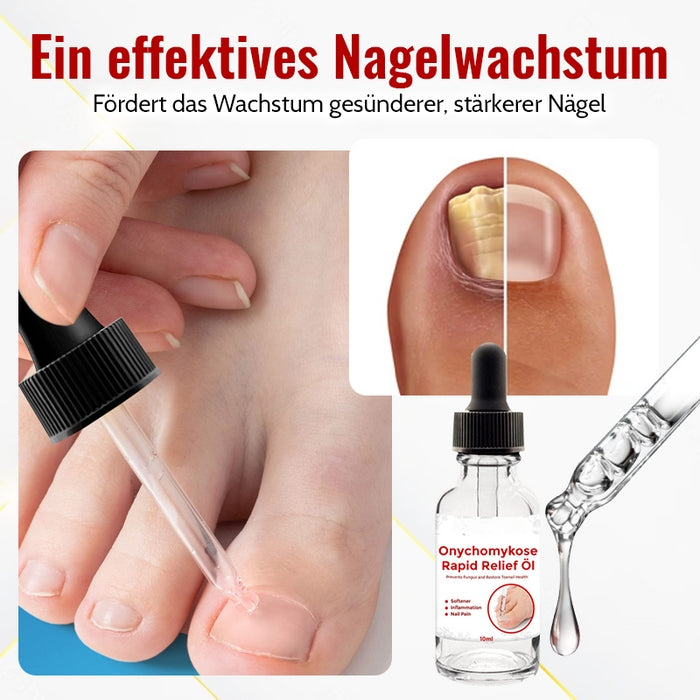 FungiFix™️ - Onychomykose Rapid Relief Öl (1+1 GRATIS)