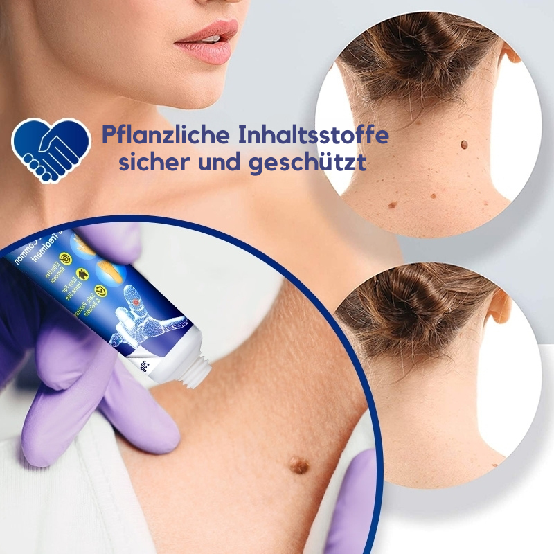 Sumifun® - Warzenentferner-Salbe (1+1 GRATIS)