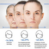 West&Month™ Botox Anti-Aging-Serum (1+1 GRATIS)