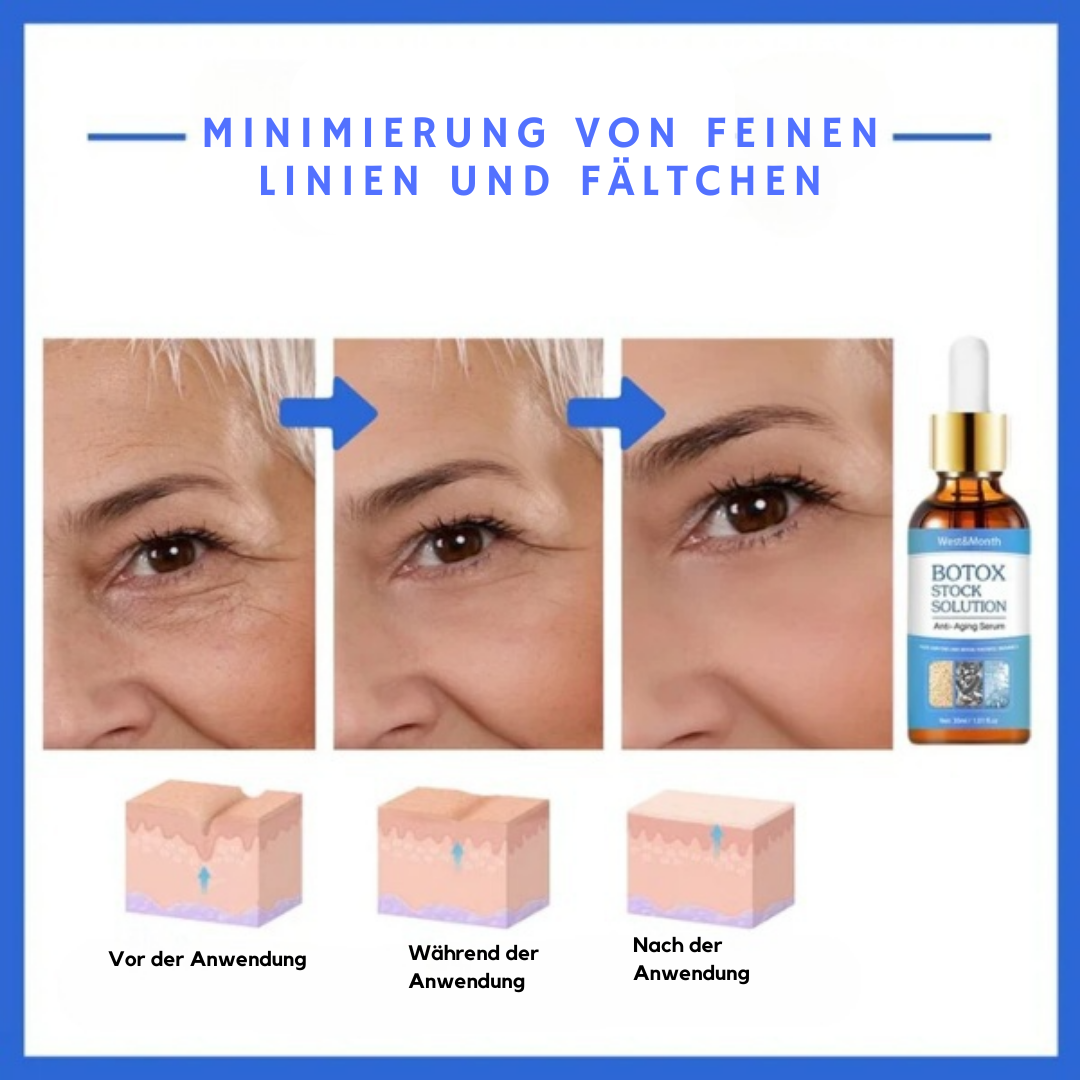 West&Month™ Botox Anti-Aging-Serum (1+1 GRATIS)