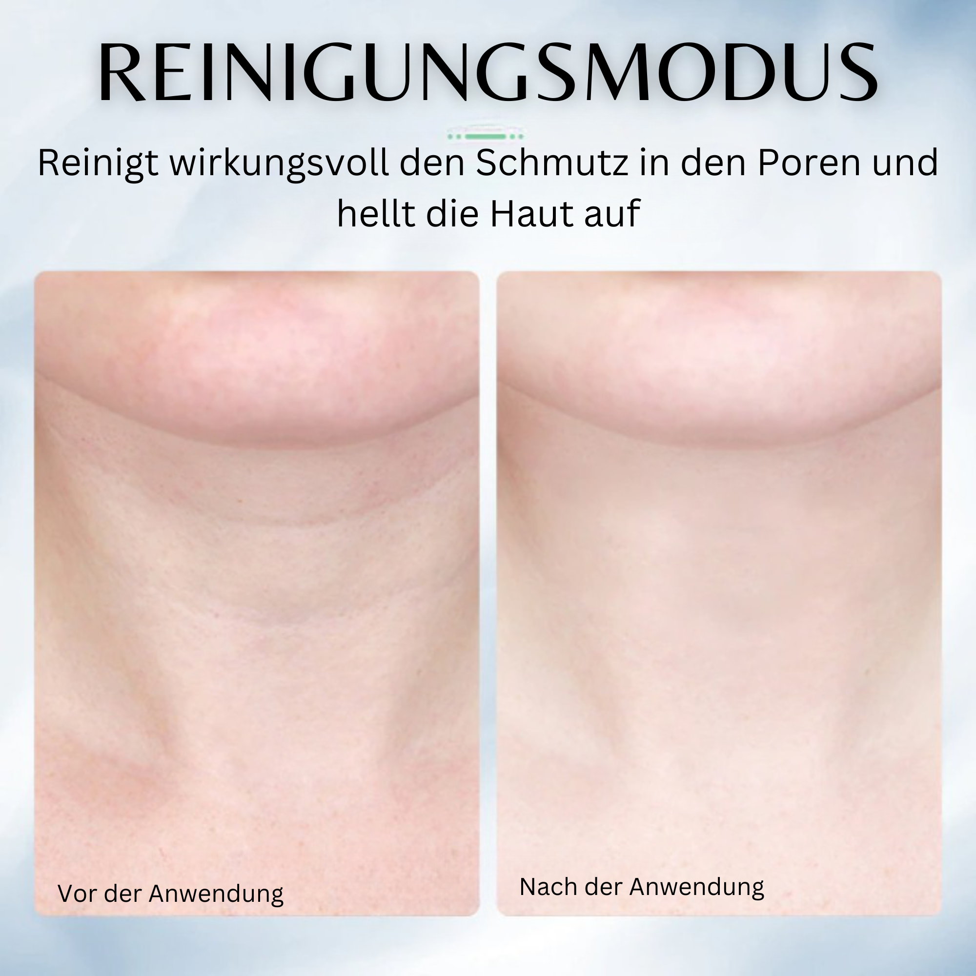 Anlan™️ Photon Hautmassagegerät