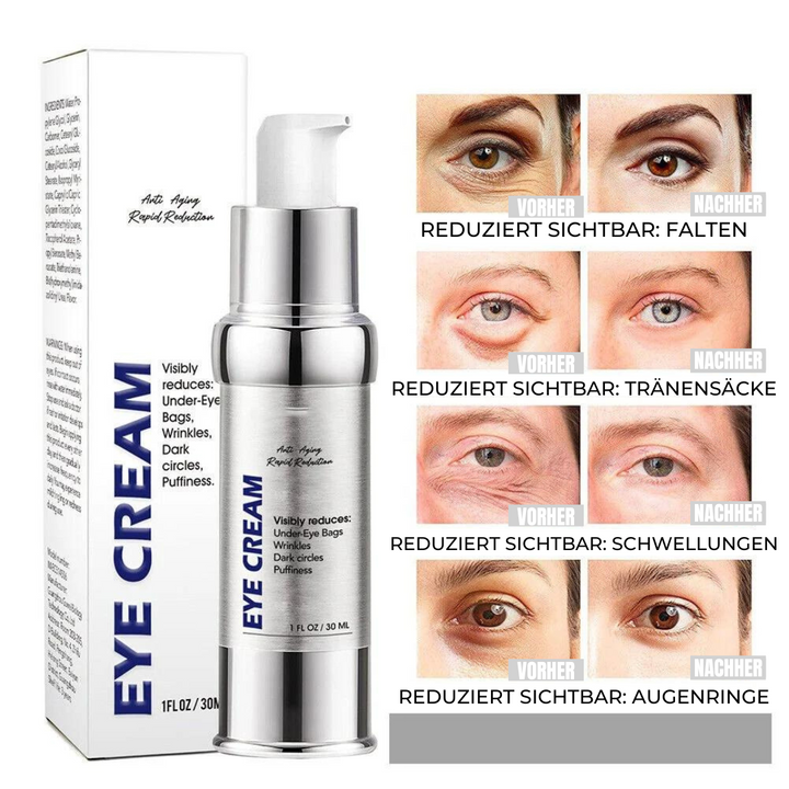 EyeZen™ - Anti-Falten Augencreme (1+1 GRATIS)