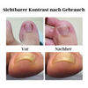 Jaysuing™️ I Anti-paronychie-Erleichterungsöl (1+1 GRATIS)