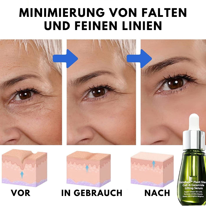 SkinReju™ - Ceramid Lifting Serum (1+1 GRATIS)