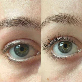 IMAGES™ | Wimpernwachstumsserum (1+1 GRATIS)