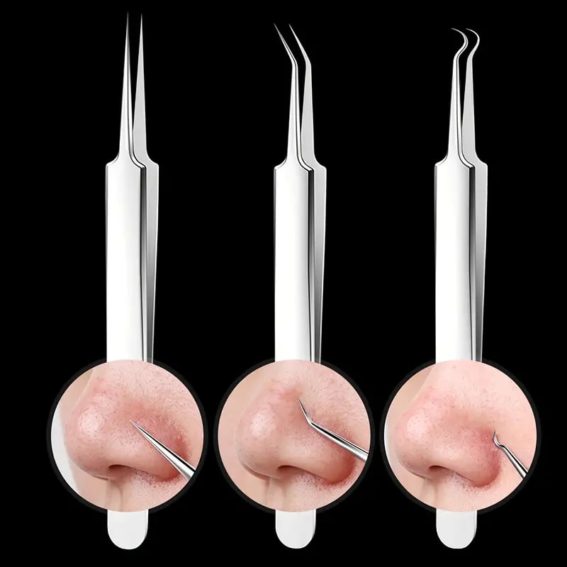 ClearPore™ | Mitesser-Pinzetten-Entferner-Set (1+1 GRATIS)
