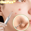 ClearPore™ | Mitesser-Pinzetten-Entferner-Set (1+1 GRATIS)