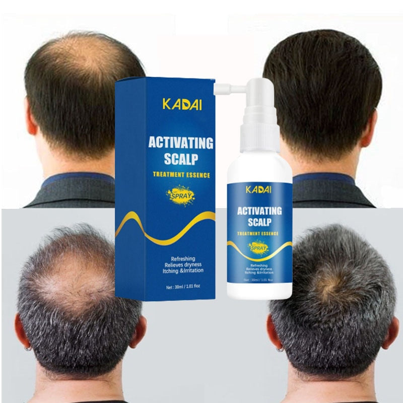 Kadai™️ I  Haarwachstumsspray
