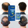 Kadai™️ I  Haarwachstumsspray